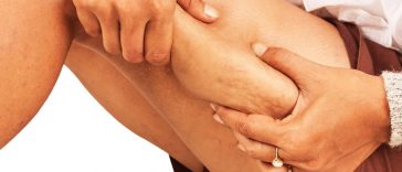 how to reduce thigh fat